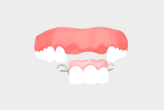 他の歯への影響３
