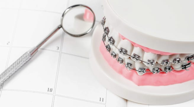 唇側矯正イメージ画像