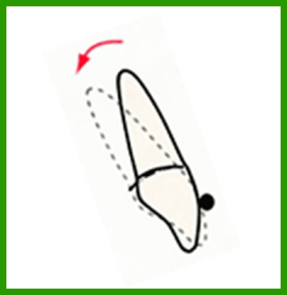 トルク