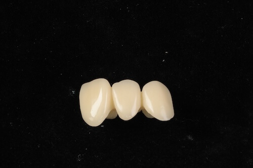 ブリッジのイメージ