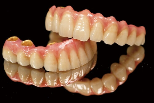 インプラントのイメージ